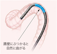 細径のしなやかなスコープを使用